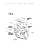 RF Energy Delivery System and Method diagram and image