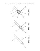 RF Energy Delivery System and Method diagram and image