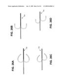 RF Energy Delivery System and Method diagram and image