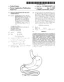 Devices and methods for treating morbid obesity diagram and image