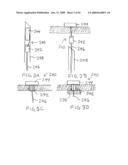 Devices and methods for treating morbid obesity diagram and image