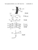 Devices and methods for treating morbid obesity diagram and image