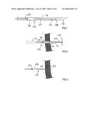 Devices and methods for treating morbid obesity diagram and image