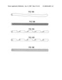 Devices and methods for treating morbid obesity diagram and image