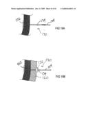 Devices and methods for treating morbid obesity diagram and image