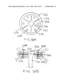 Devices and methods for treating morbid obesity diagram and image