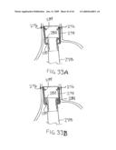 Devices and methods for treating morbid obesity diagram and image