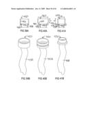 Devices and methods for treating morbid obesity diagram and image