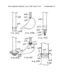 Devices and methods for treating morbid obesity diagram and image