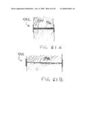 Devices and methods for treating morbid obesity diagram and image