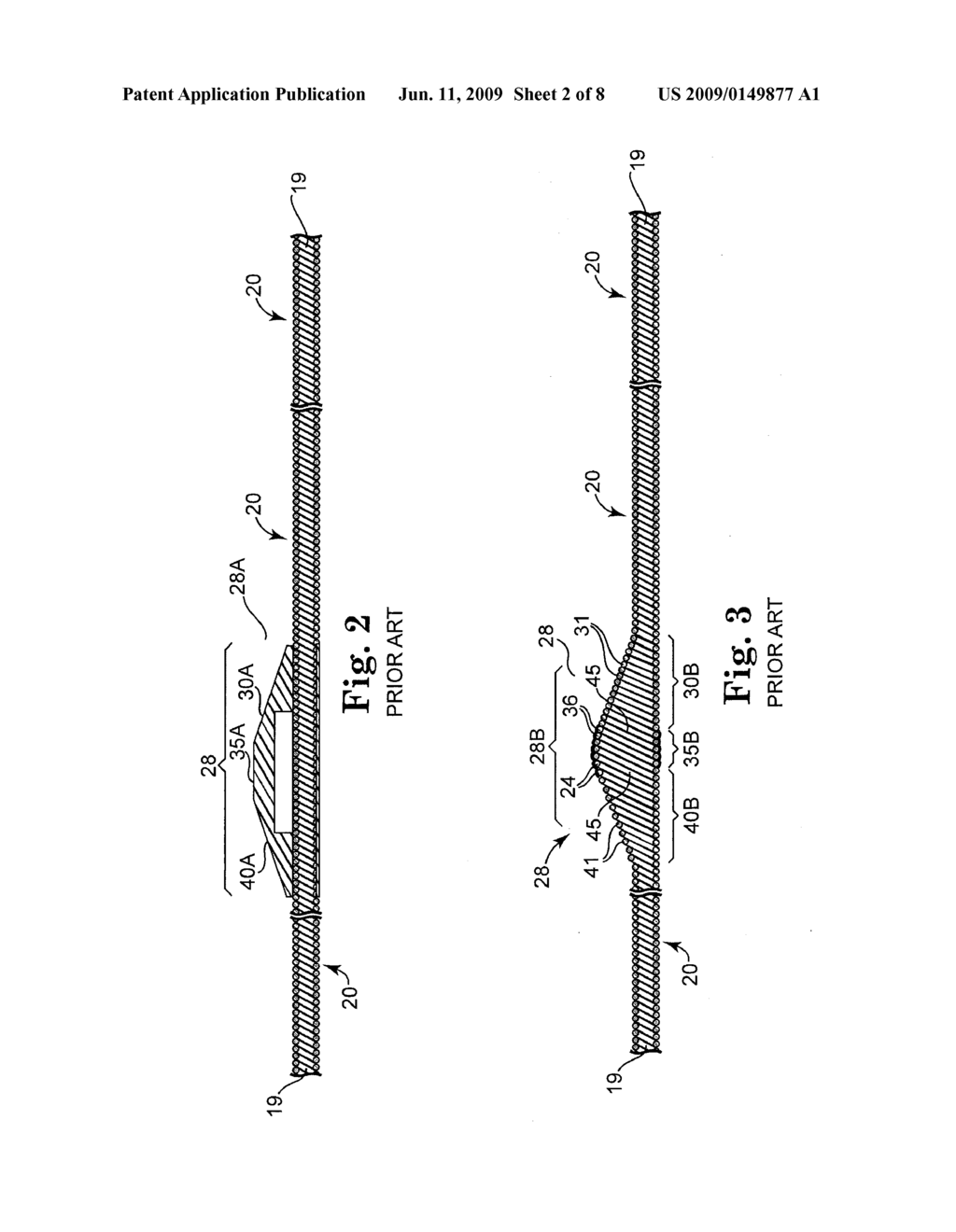 ROTATIONAL ATHERECTOMY DEVICE WITH PRE-CURVED DRIVE SHAFT - diagram, schematic, and image 03