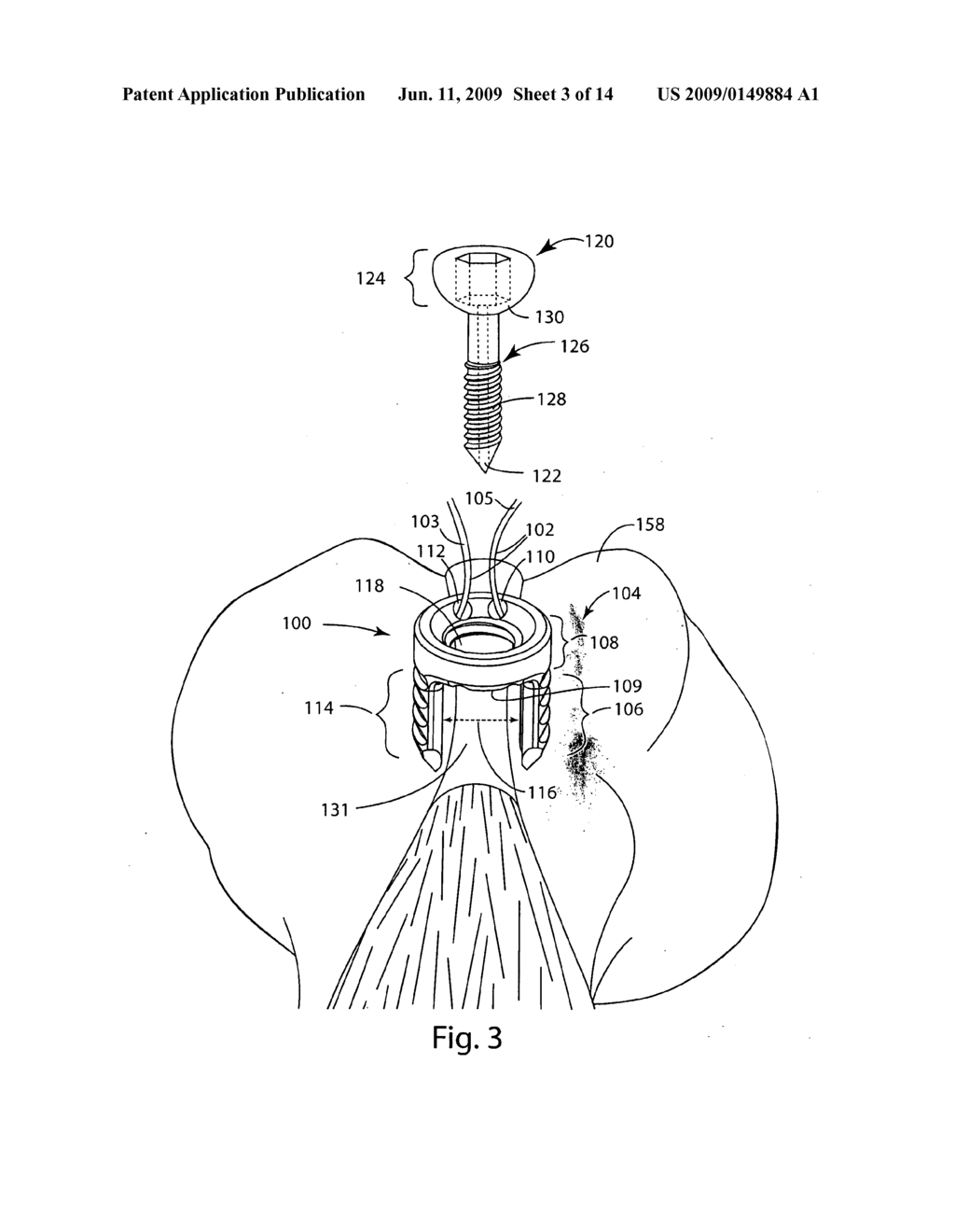 SYSTEM AND METHOD FOR BRIDGE ANCHOR TENDON ATTACHMENT - diagram, schematic, and image 04