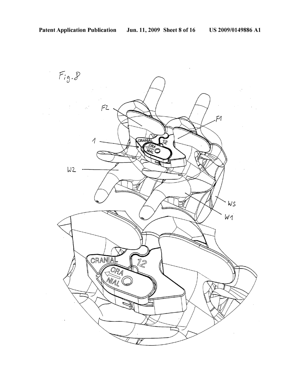 IMPLANTATION - diagram, schematic, and image 09