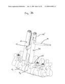 SYSTEM AND METHOD OF MANIPULATING SPINAL CONSTRUCTS diagram and image