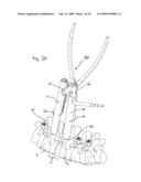 SYSTEM AND METHOD OF MANIPULATING SPINAL CONSTRUCTS diagram and image