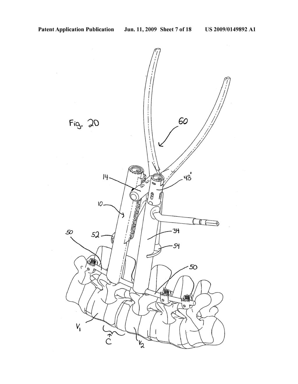 SYSTEM AND METHOD OF MANIPULATING SPINAL CONSTRUCTS - diagram, schematic, and image 08