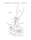 SYSTEM AND METHOD OF MANIPULATING SPINAL CONSTRUCTS diagram and image