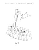 SYSTEM AND METHOD OF MANIPULATING SPINAL CONSTRUCTS diagram and image