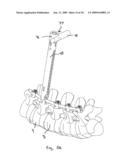 SYSTEM AND METHOD OF MANIPULATING SPINAL CONSTRUCTS diagram and image