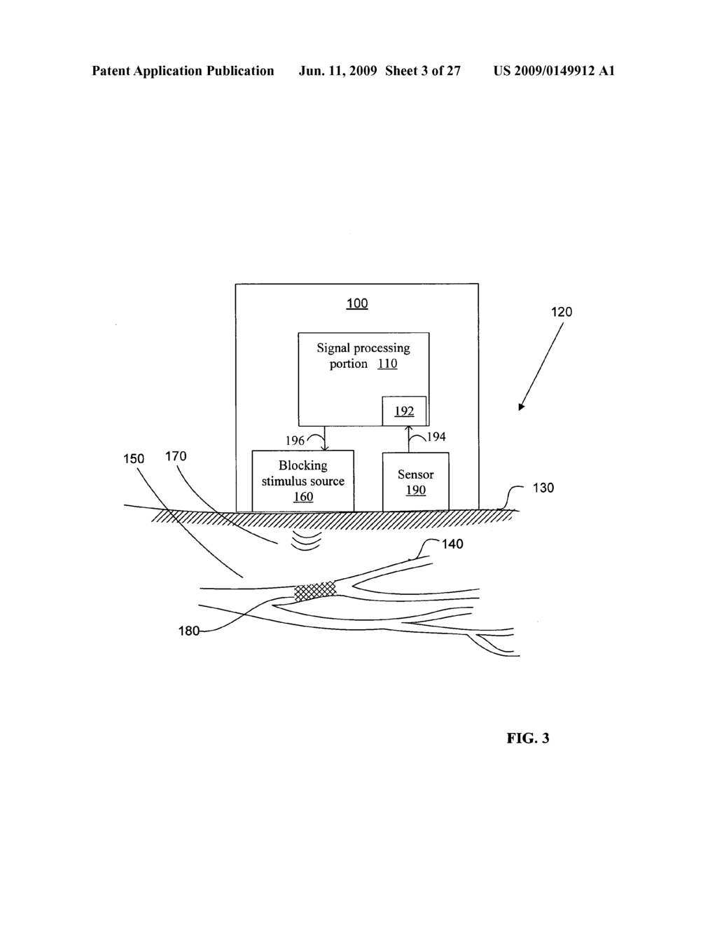 Method for electrical modulation of neural conduction - diagram, schematic, and image 04