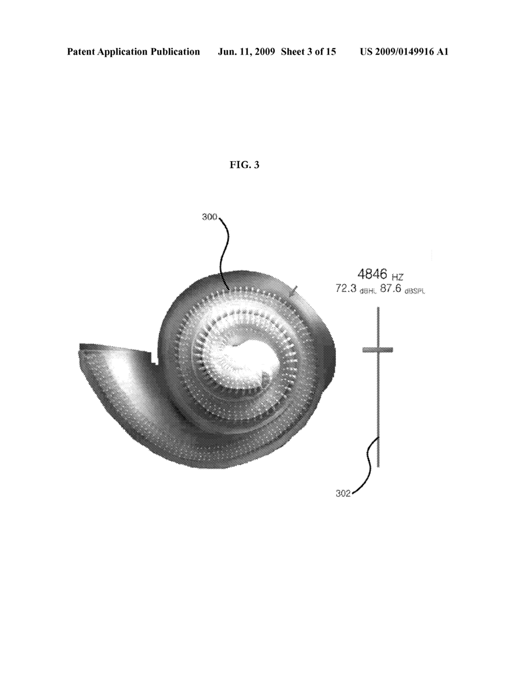 METHOD AND APPARATUS FOR HAIR CELL STIMULATION USING ACOUSTIC SIGNALS - diagram, schematic, and image 04