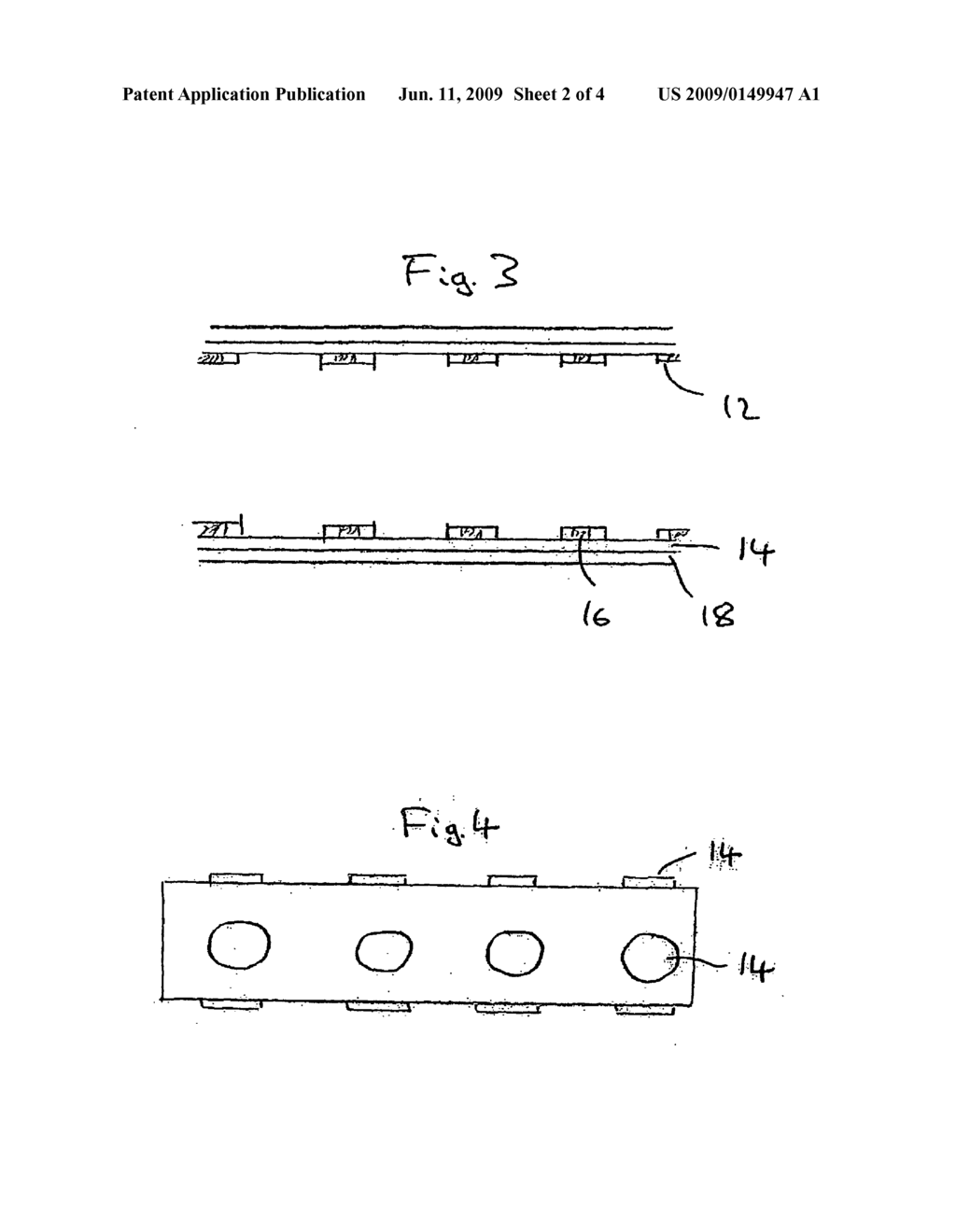 Implantable device for drug delivery and improved visibility - diagram, schematic, and image 03