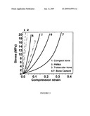 Bone substitute diagram and image