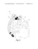 Head Positioning Aid diagram and image