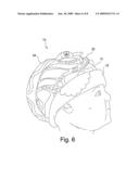 Head Positioning Aid diagram and image