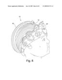 Head Positioning Aid diagram and image