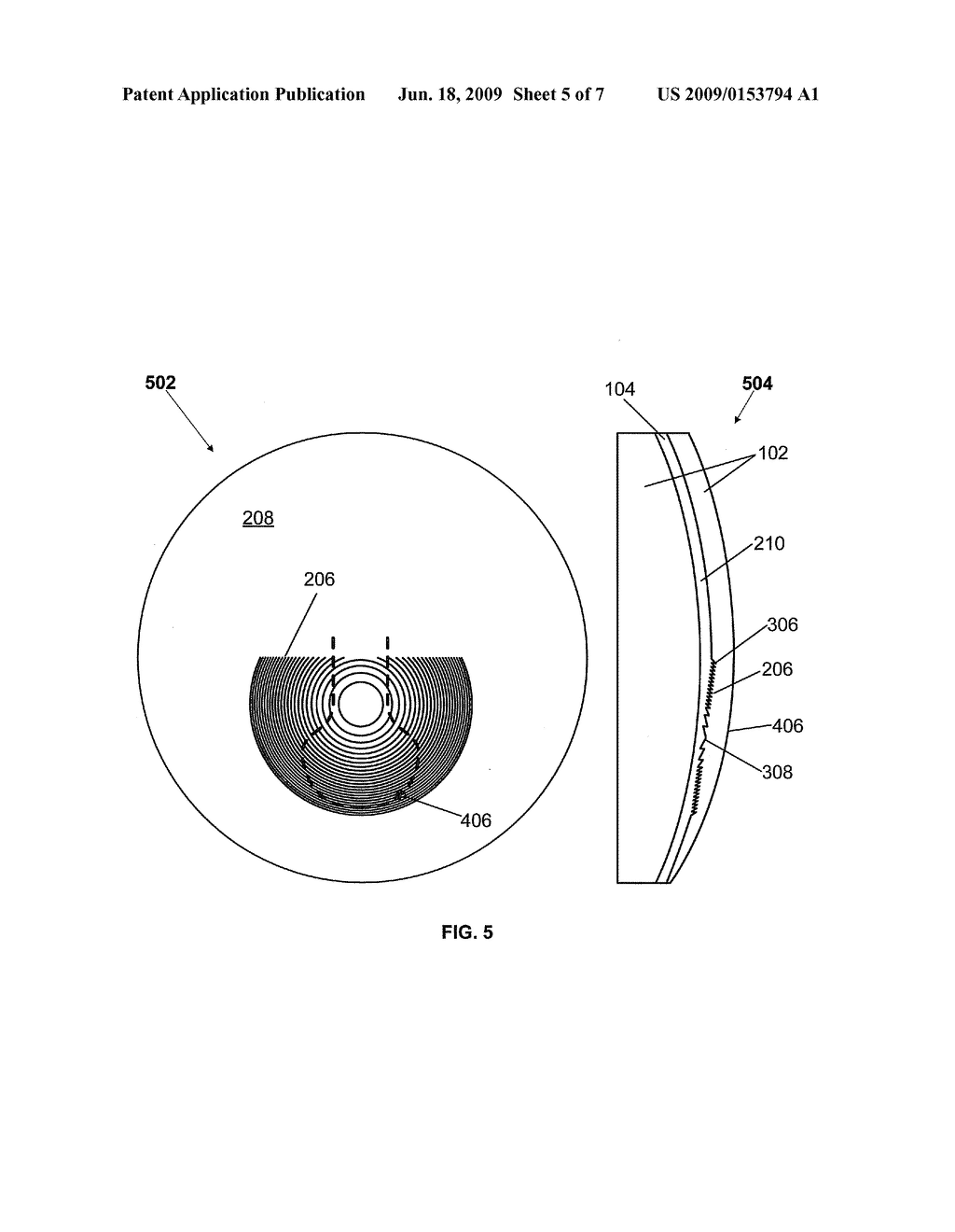 REFRACTIVE-DIFFRACTIVE MULTIFOCAL LENS - diagram, schematic, and image 06