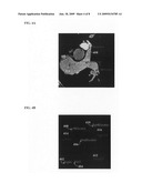 Method and system for dynamic pulmonary trunk modeling in computed tomography and magnetic resonance imaging diagram and image