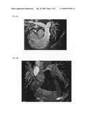 Method and system for dynamic pulmonary trunk modeling in computed tomography and magnetic resonance imaging diagram and image