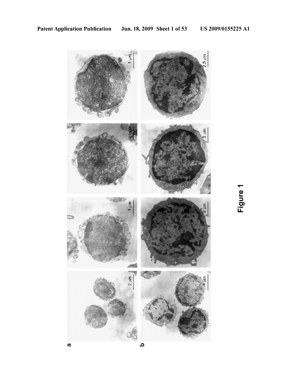 USES AND ISOLATION OF VERY SMALL OF EMBRYONIC-LIKE (VSEL) STEM CELLS - diagram, schematic, and image 02