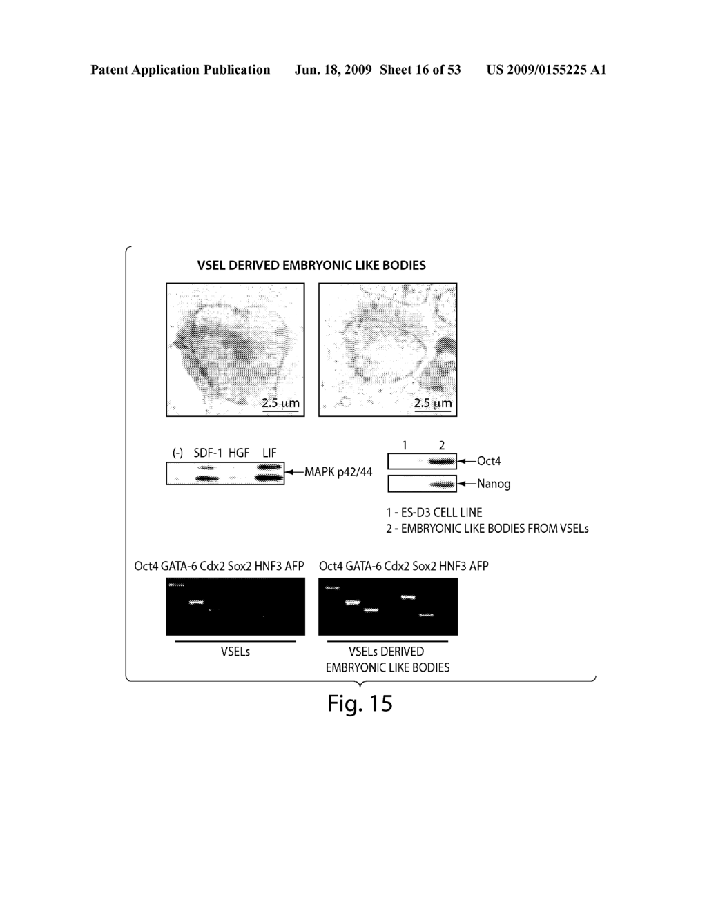 USES AND ISOLATION OF VERY SMALL OF EMBRYONIC-LIKE (VSEL) STEM CELLS - diagram, schematic, and image 17