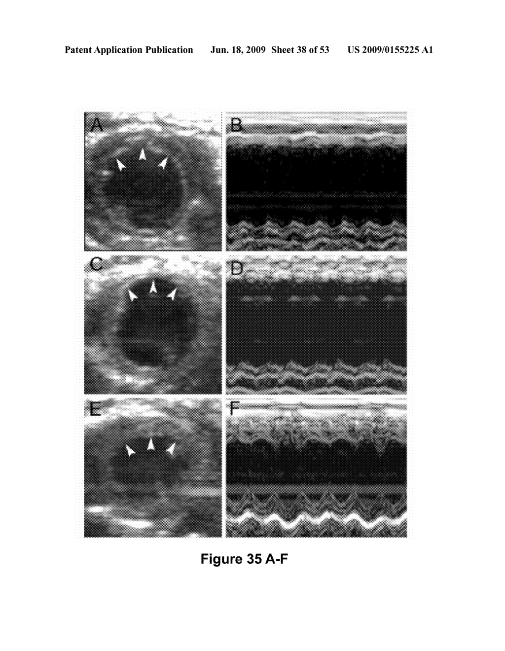 USES AND ISOLATION OF VERY SMALL OF EMBRYONIC-LIKE (VSEL) STEM CELLS - diagram, schematic, and image 39