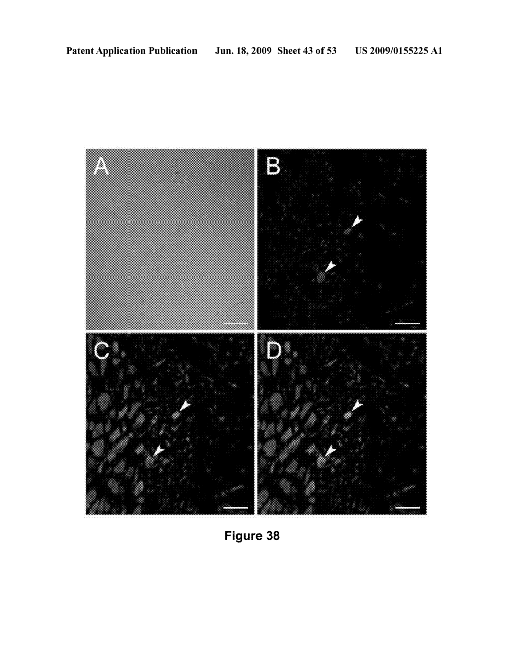 USES AND ISOLATION OF VERY SMALL OF EMBRYONIC-LIKE (VSEL) STEM CELLS - diagram, schematic, and image 44