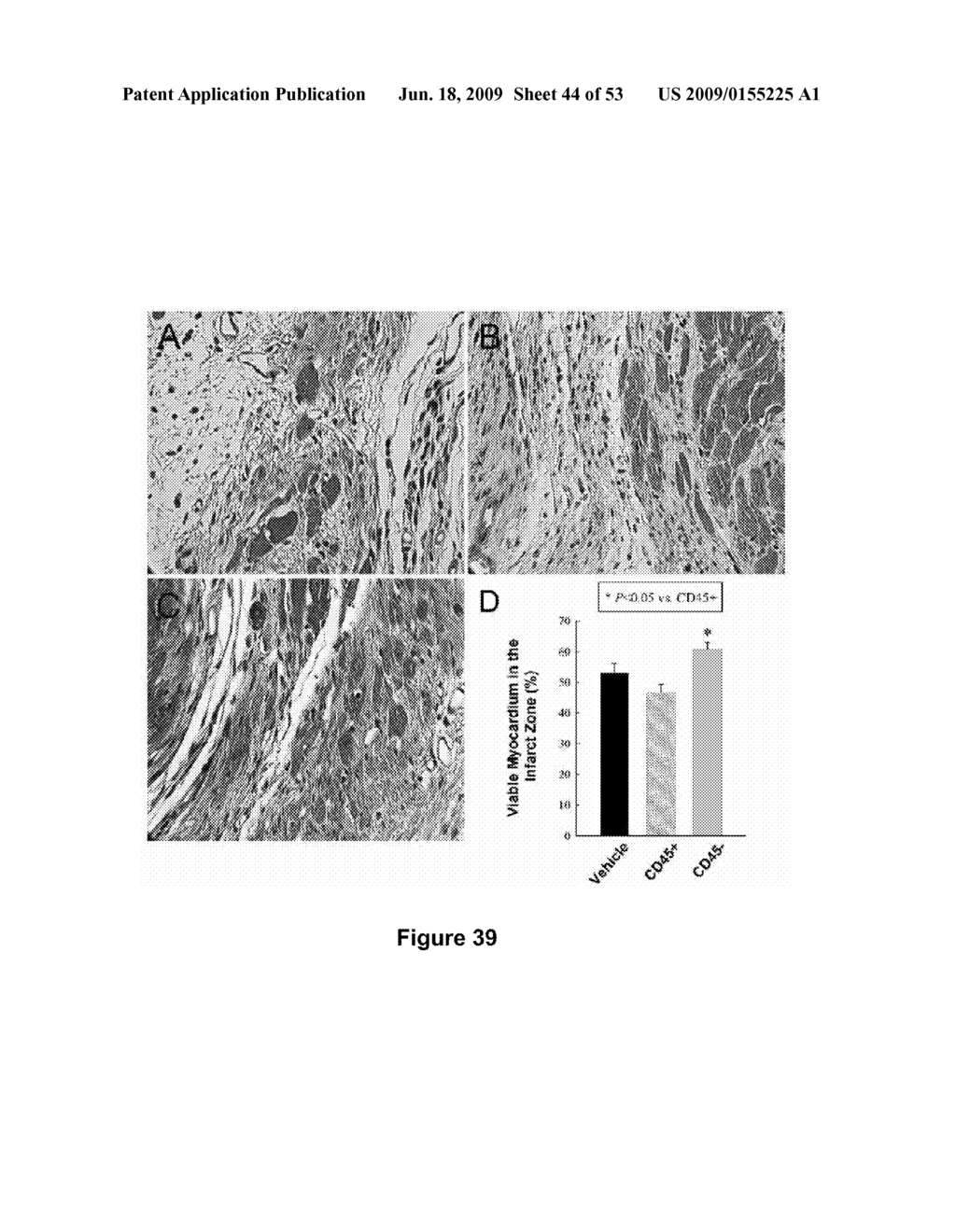 USES AND ISOLATION OF VERY SMALL OF EMBRYONIC-LIKE (VSEL) STEM CELLS - diagram, schematic, and image 45