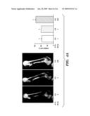 COMPOSITIONS AND METHODS FOR BONE STRENGTHENING diagram and image