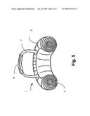 Medical device and a method for applying a biochemically active material on one or more body parts diagram and image