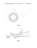 Medical device and a method for applying a biochemically active material on one or more body parts diagram and image