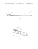 Dental contact adjustment tool diagram and image