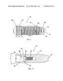 Dental Implant Identification System diagram and image