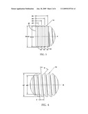 Dental Implant Identification System diagram and image