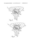 Tooth implant with a primary and a secondary crown diagram and image