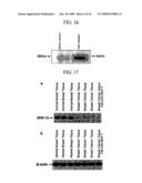 Human Cancer Suppressor Gene, Protein Encoded Therein, Expression Vector Containing The Same, And Cell Transformed By The Vector diagram and image