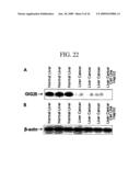 Human Cancer Suppressor Gene, Protein Encoded Therein, Expression Vector Containing The Same, And Cell Transformed By The Vector diagram and image