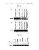 Human Cancer Suppressor Gene, Protein Encoded Therein, Expression Vector Containing The Same, And Cell Transformed By The Vector diagram and image