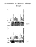 Human Cancer Suppressor Gene, Protein Encoded Therein, Expression Vector Containing The Same, And Cell Transformed By The Vector diagram and image