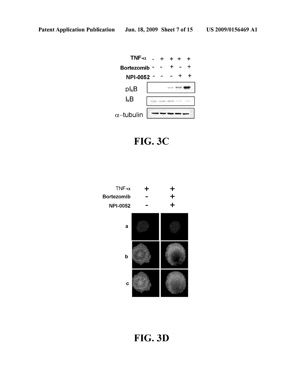 METHODS OF USING [3.2.0] HETEROCYCLIC COMPOUNDS AND ANALOGS THEREOF IN TREATING WALDENSTROM'S MACROGLOBULINEMIA - diagram, schematic, and image 08